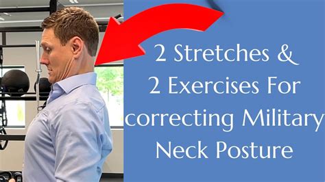 What posture causes military neck?