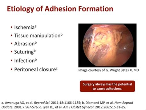 What prevents adhesion formation?
