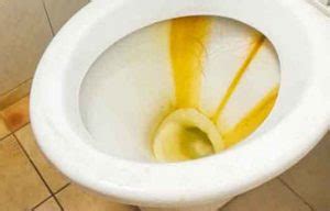 What removes yellow pee stains?