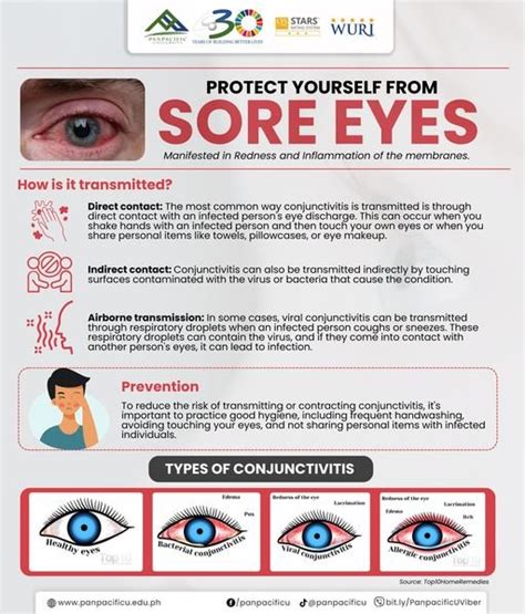 What should avoid if you have sore eyes?