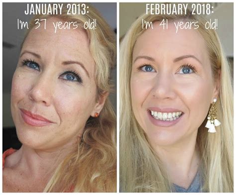 What should skin look like at 40?