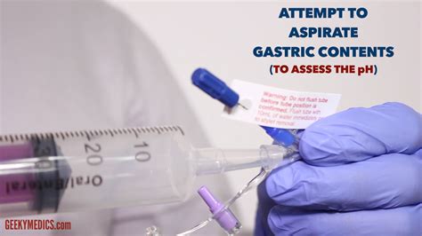 What should you assess before removing an NG tube?