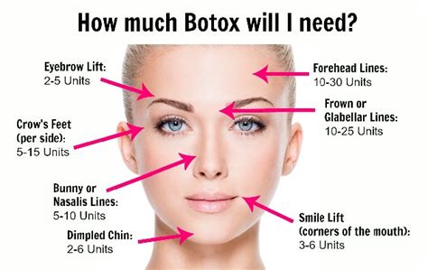 What should you avoid during Botox?