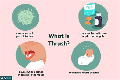 What should you not do when you have thrush?