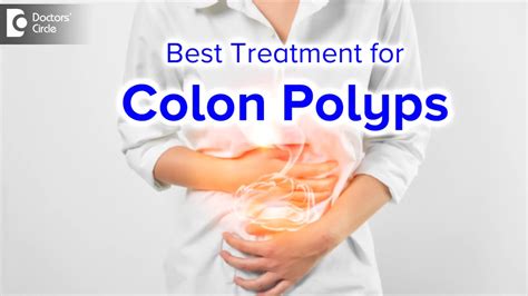 What size colon polyps should be removed?