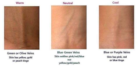 What skin tone is blue veins?