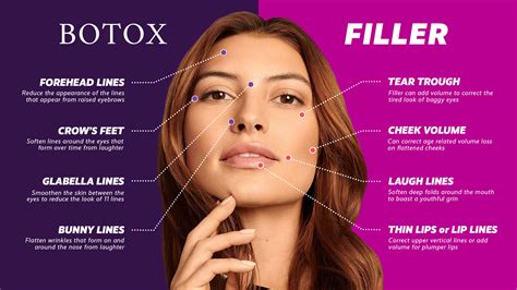 What skincare products to use after Botox?