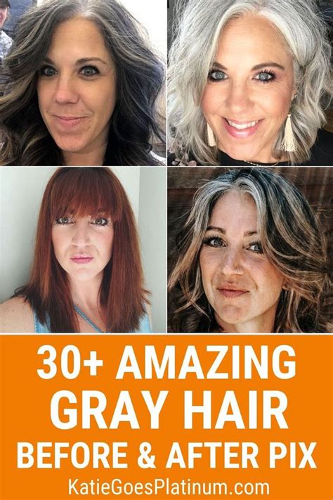 What speeds up gray hair?