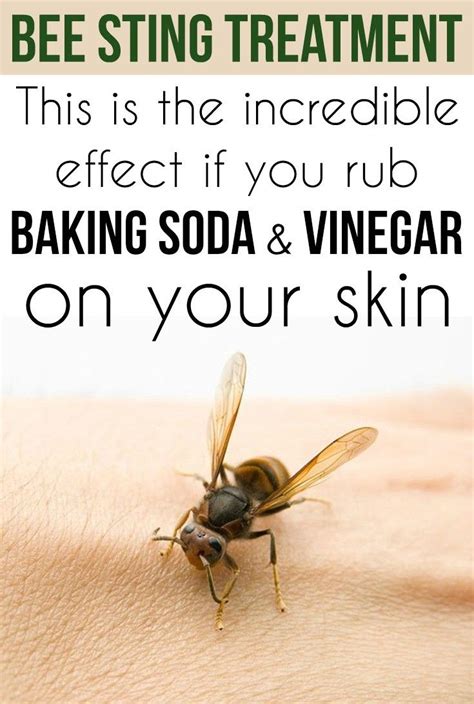 What stings can be treated with vinegar?