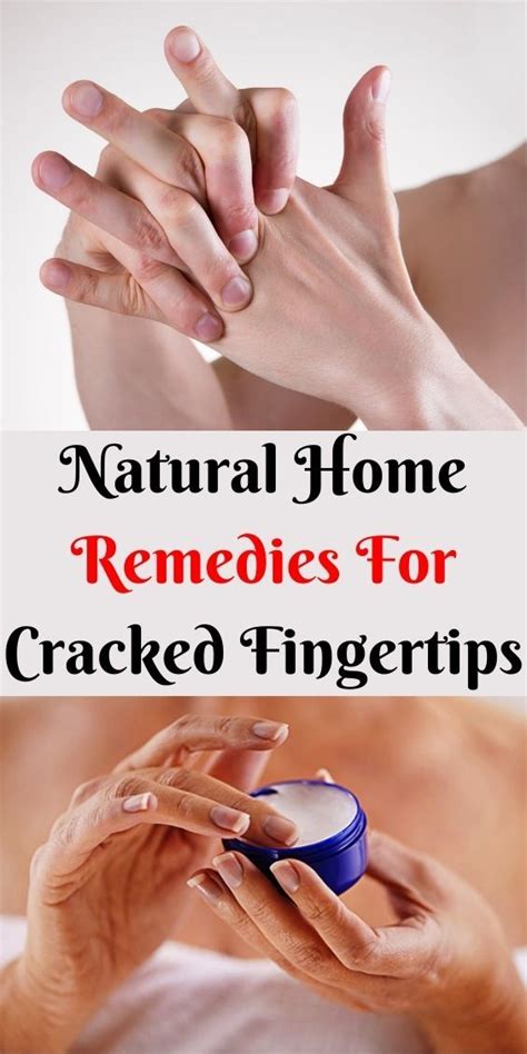 What supplements are good for cracked fingertips?