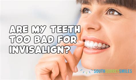 What teeth are too bad for Invisalign?