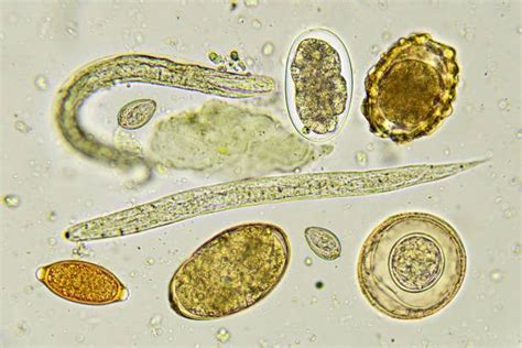 What temp kills parasite eggs?