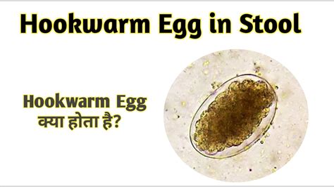 What temperature kills hookworm eggs?