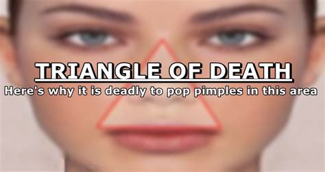 What to do if I popped a pimple in the triangle of death?