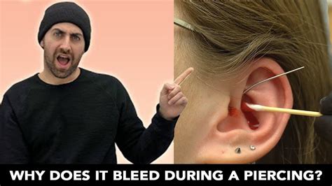 What to do if piercing is bleeding?