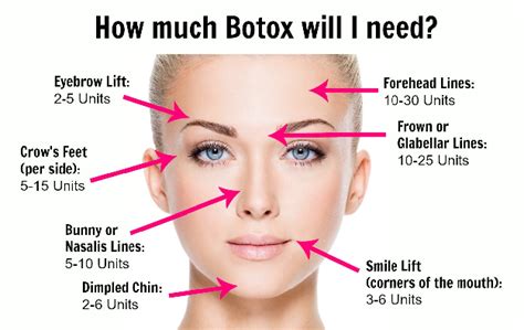 What to do if you hate your Botox?