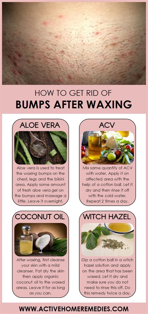 What to do immediately after a wax?