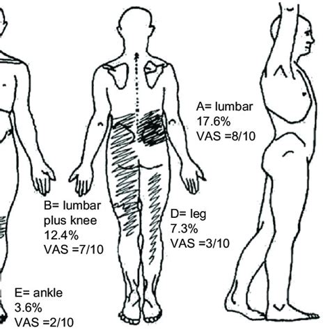 What trauma is stored in lower back?