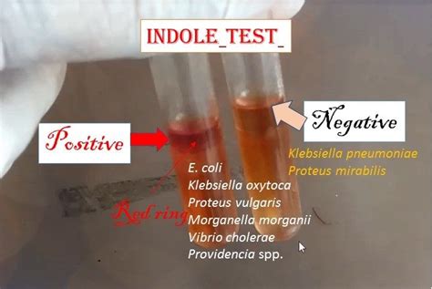 What type of bacteria produce indole?