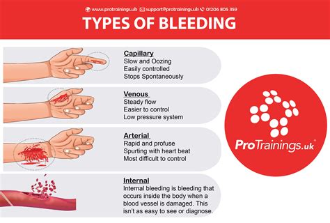 What type of bleeding is most serious?