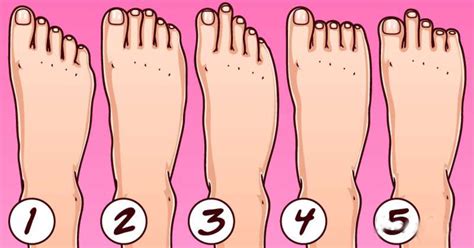 What type of feet are most common?