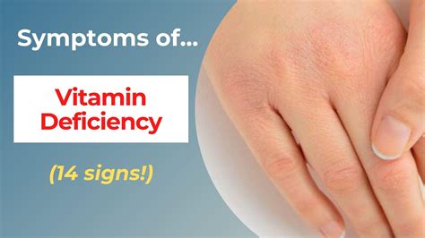 What vitamin deficiency causes cracked fingers?
