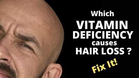 What vitamin deficiency causes greasy hair?