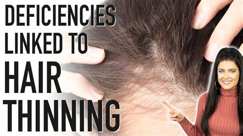 What vitamin deficiency causes greasy hair?
