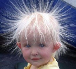 What vitamin deficiency causes static electricity?
