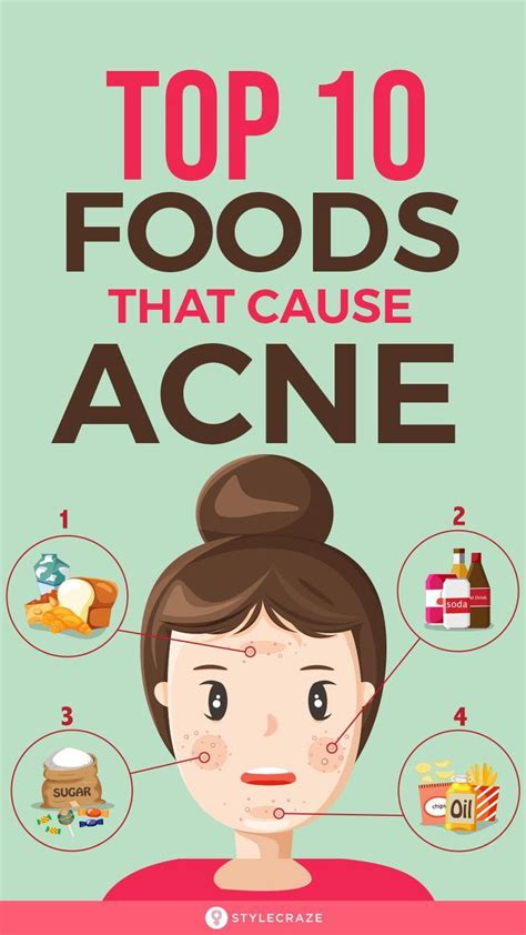 What vitamins worsen acne?