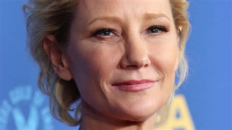What was the medical condition of Anne Heche?