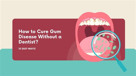 What will happen if I don't treat gum disease?