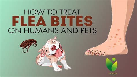 What will stop fleas from biting me?
