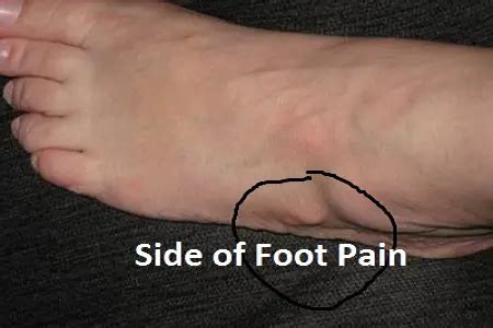 What would cause pain on the left side of my left foot?