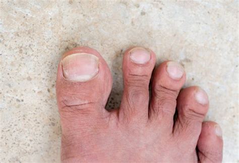 What your feet are trying to tell you?