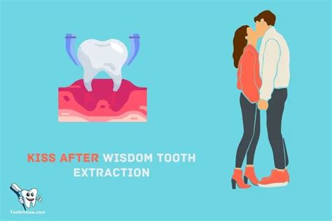 When can you kiss after tooth extraction?