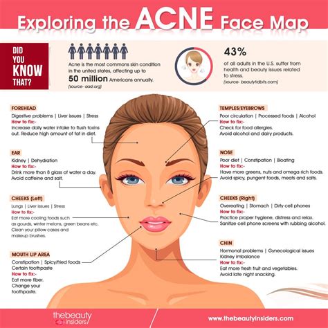 When does acne peak?