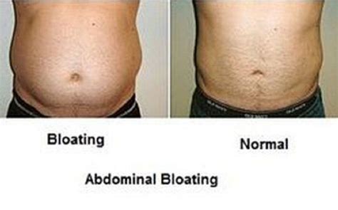 When is belly fat not normal?