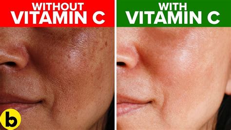 When not to use vitamin C on skin?