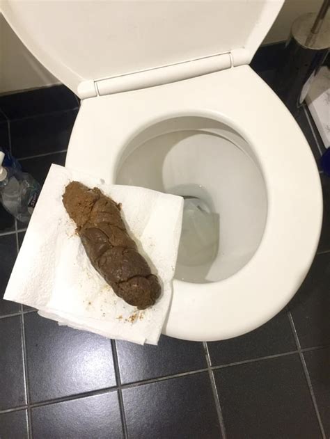 When poop is too big to come out?