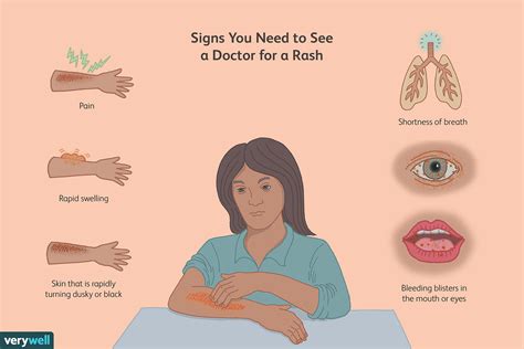 When should I be worries about a rash?