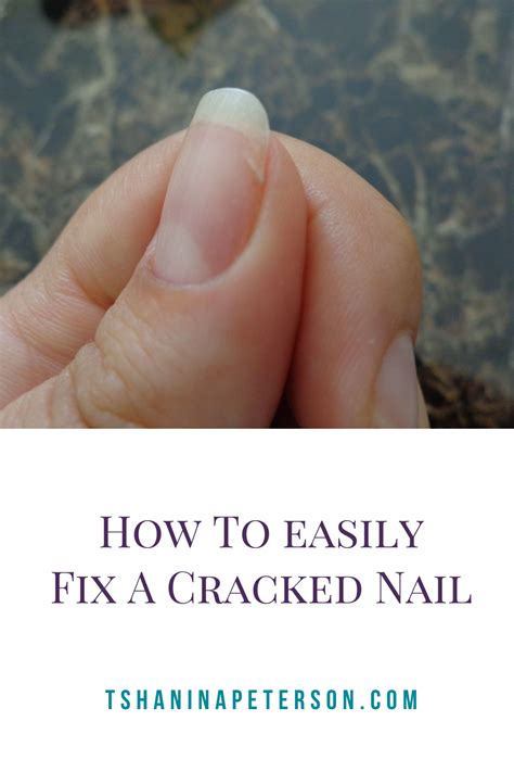 When should I fix my nail bed?