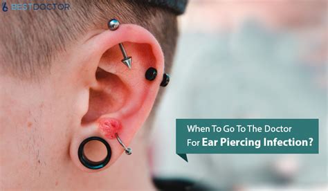 When should I go to the doctor for an infected ear piercing?