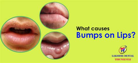 When should I worry about bump in mouth?