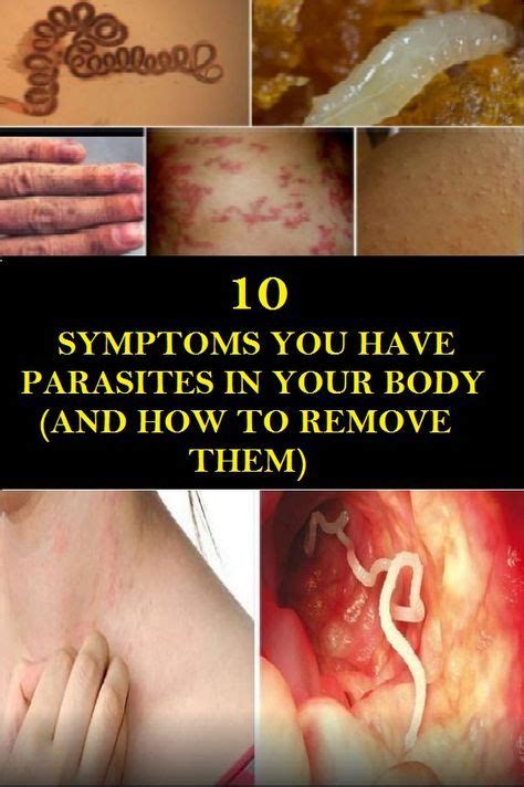 Where do parasites hide in the body?