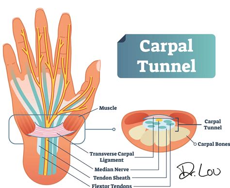 Where do you press for carpal tunnel?