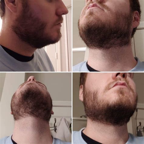 Where do you shave your neck beard?