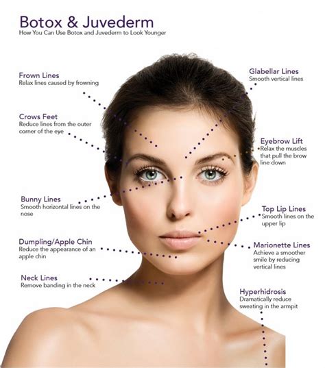 Where not to get Botox on face?