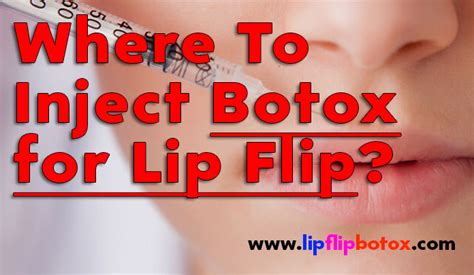 Where not to inject Botox?