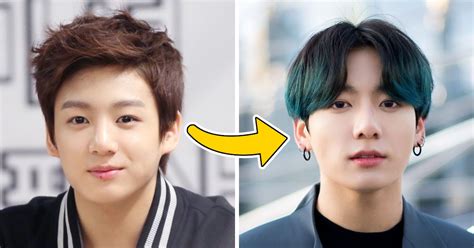 Which BTS member had plastic surgery?